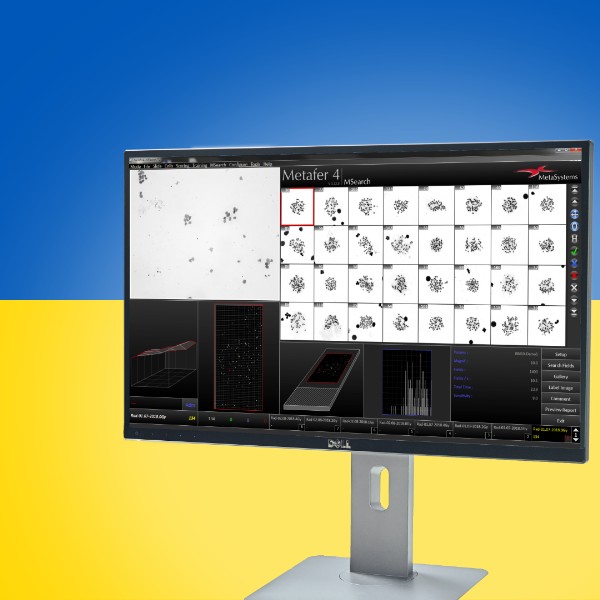 MetaSystems and Märzhäuser Wetzlar donate state-of-the-art medical equipment to Ukrainian children's clinic